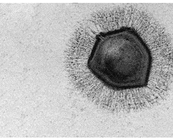 Picture 9 of Where do viruses come from and are they living things?