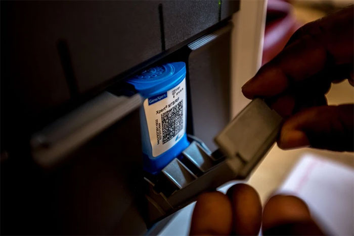 Picture 1 of WHO approves first rapid, accurate test for tuberculosis