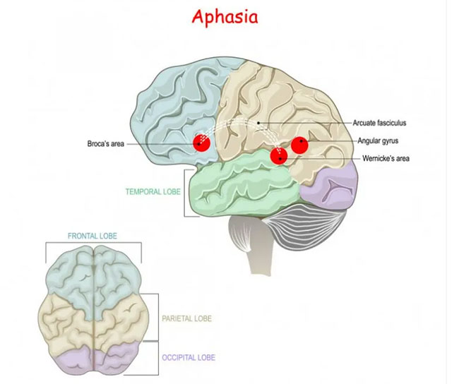 Picture 3 of Why can humans talk but apes can't?