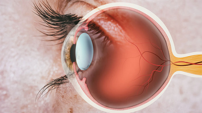Picture 4 of Why did scientists once think that the retina of the dead is the place to store memories?