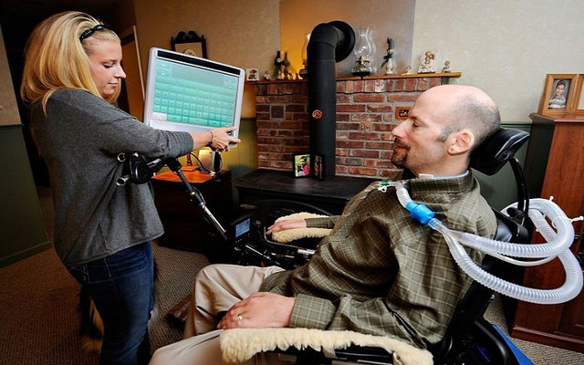 Picture 4 of Why do most people with ALS not live more than 5 years, but Hawking lived to be 55?