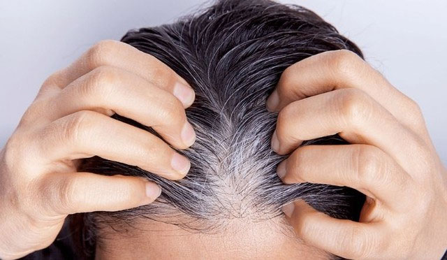 Picture 1 of Why does gray hair never turn black again?