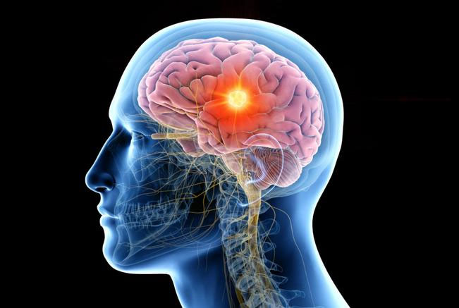 Why is the brain the largest energy consumer in the body?