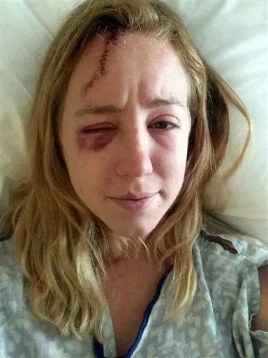 Picture 2 of Woman suddenly gains new senses after being struck by lightning