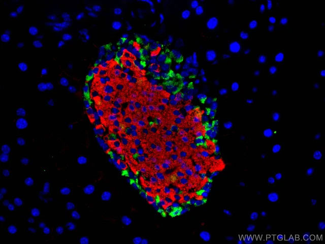 Picture 4 of World's first patient cured of diabetes thanks to miraculous stem cells