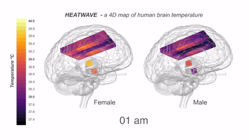Picture 4 of Your brain can heat up to 41 degrees Celsius if you think a lot