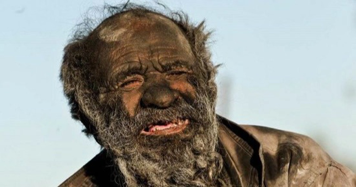 60 years without bathing, the body will be like?