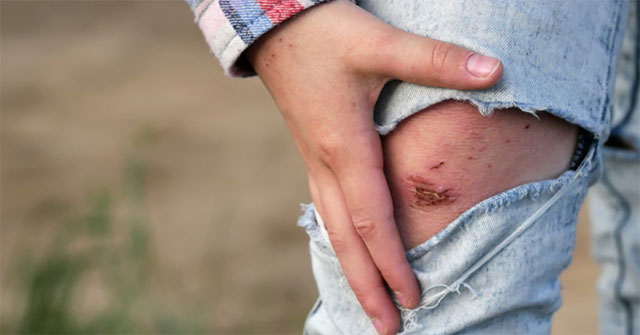 Animals that cause many cases of rabies in humans you should know