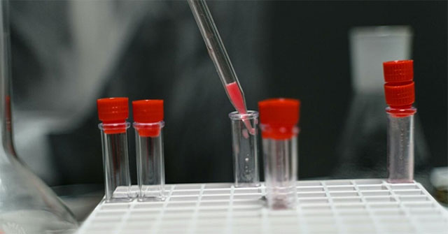 Australia loses 300 vials of deadly virus