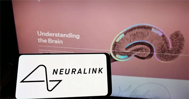 Canada agrees to let billionaire Elon Musk's company test chip implant in human brain