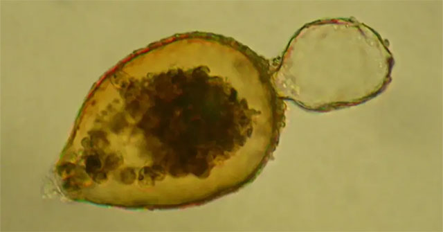 Close-up of magnetic bacteria residing in the deepest part of the ocean