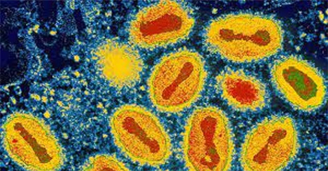 Deadly epidemic viruses once 'disappeared without a trace'