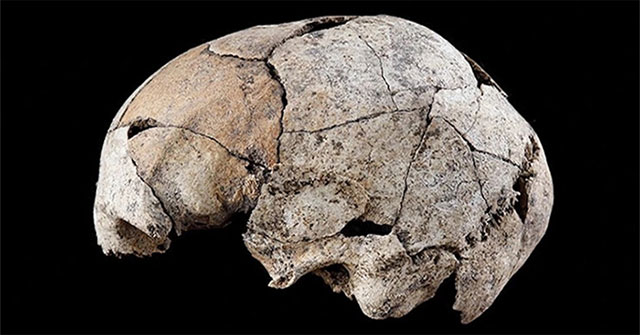 Discovered the first ear surgery from the ancient skull 5,300 years ago