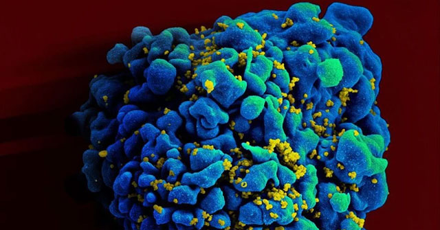 Discovered the second person in the world to cure himself of HIV