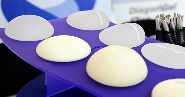 Do breast implants have an expiration date? Why do they break?