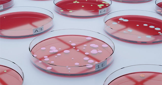 Drug-resistant bacteria expected to kill tens of millions of people by 2050