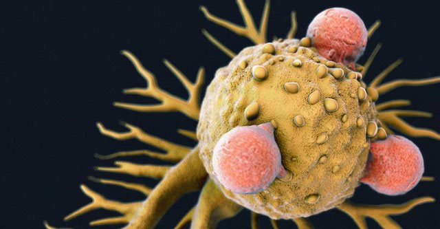 Experiment shows Covid virus can shrink tumors of 4 types of late-stage cancer