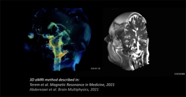 Finding the 'gateway' to deliver drugs to the brain