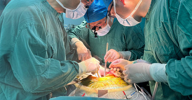 First successful pig liver transplant to a living person