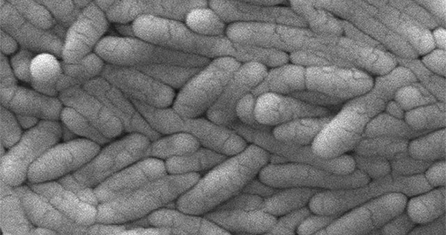 Food poisoning bacteria may help fight cancer