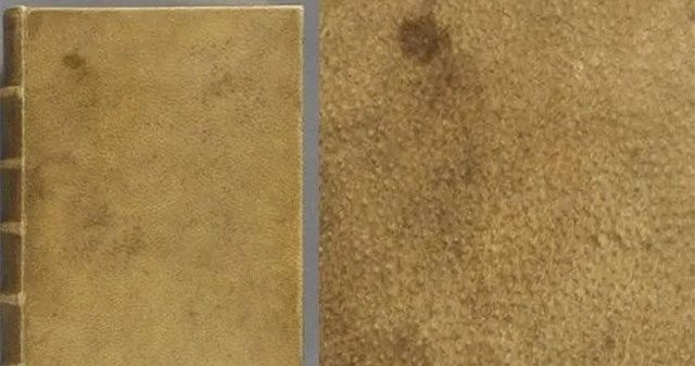 Harvard University removed the human skin used as a book cover