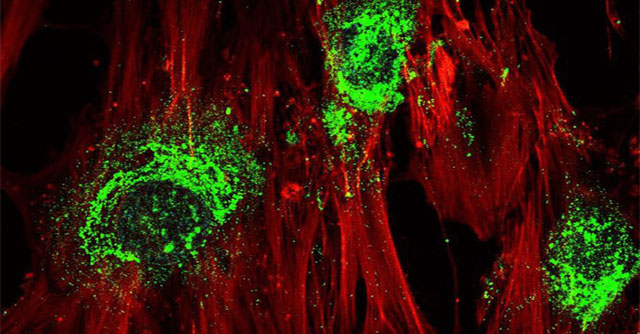 High-frequency sound waves turn stem cells into bone cells in just 5 days