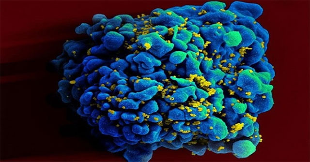 HIV-preventing mRNA vaccine gives good results in animals
