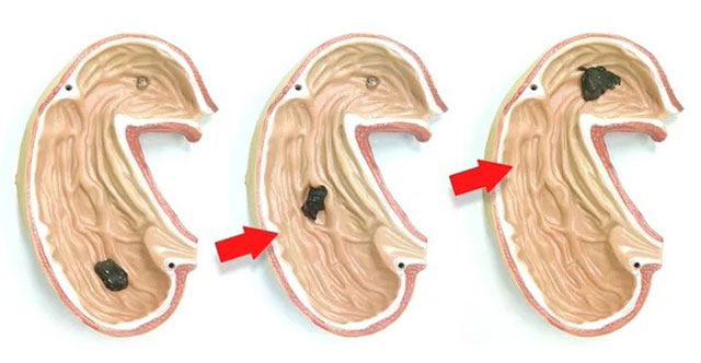 Hong Kong researchers have created a soft robot that can penetrate the human body.