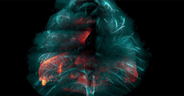 HYBRiD technology makes tissue transparent: Accelerating future disease research