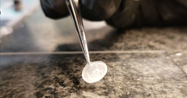 Invented 3D printed eardrum implant device