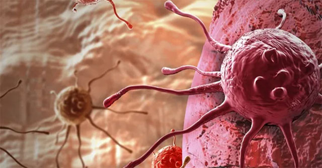 Invention of 'killer plane' that kills cancer cells