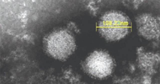 Japan confirms the first case of thrombocytopenic fever transmitted from person to person