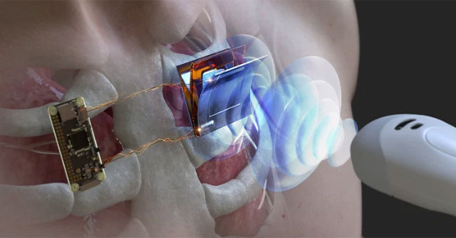 Korean research team successfully uses ultrasonic waves to charge electronic devices remotely