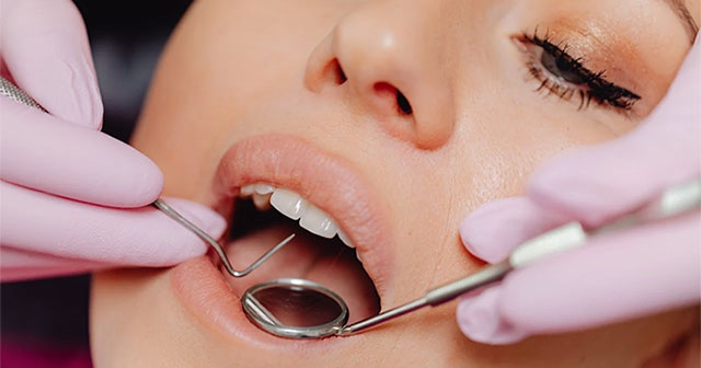 Little-known facts about tooth decay