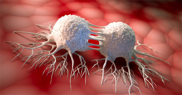 Macrophages could become 'weapons' to kill cancer