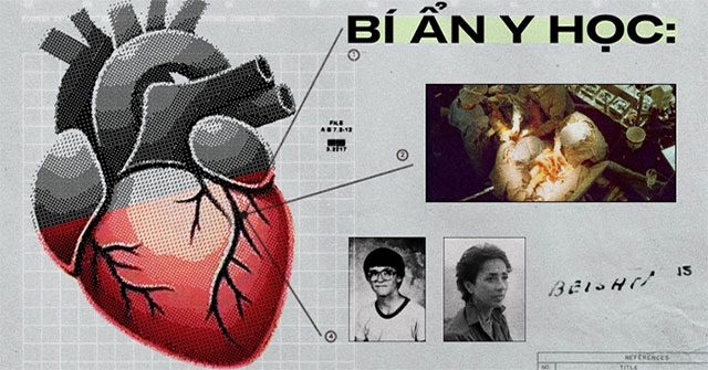 Medical Mystery: Donated Heart Tells New Owner to Find Old Owner's Home, Even Though Identity Is Hidden