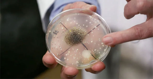 Microorganisms, mold 'attack' Space Station: Will they harm astronauts?