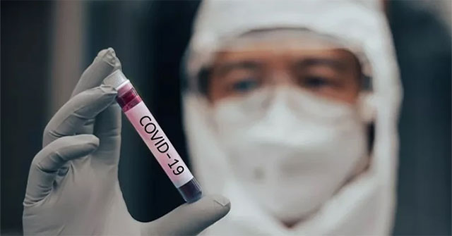 More suspicion of Covid-19 virus leaking from the laboratory