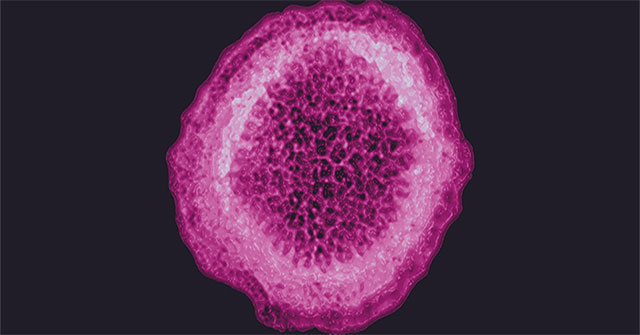 Mysterious virus causing hepatitis spreads to 11 countries, the first case dies