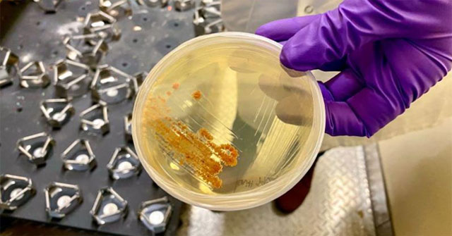 New breakthrough: Treating brain cancer with marine actinomycetes