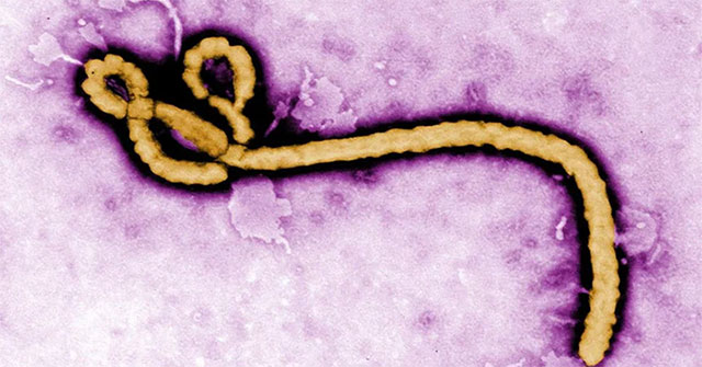 New discovery about the virus that causes 25-90% of infected people to die