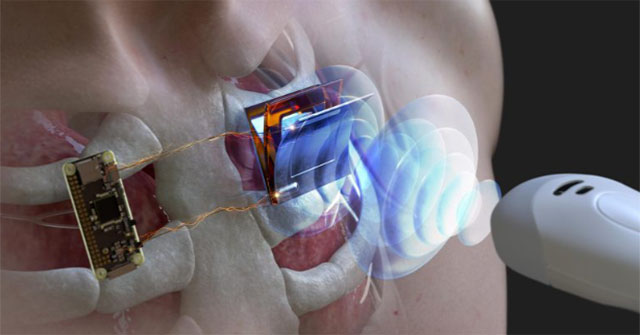New research helps to charge pacemaker batteries without surgery