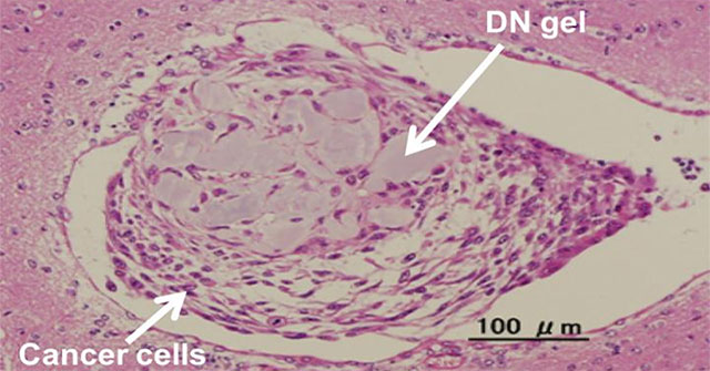 New research: Turning cancer cells into stem cells, helping to make medicine