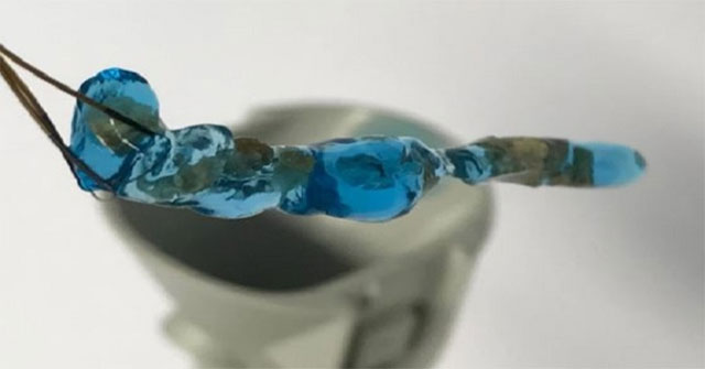 New type of Hydrogel helps to clean out kidney stones in the body