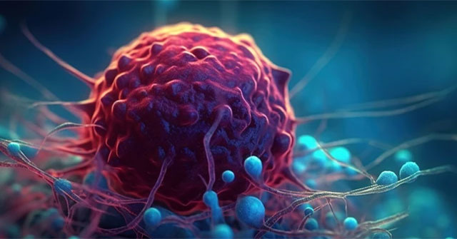 New way found to kill the world's second most common cancer