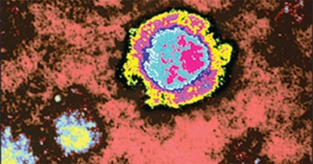 Rare virus that causes nearly 100% death suddenly 're-emerges'
