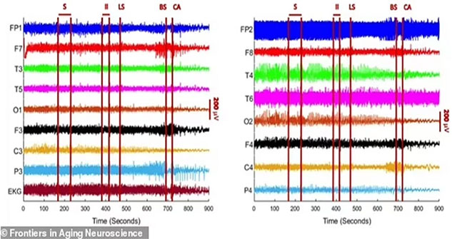 Recording the brain waves of the dead for the first time, revealing the terrible truth