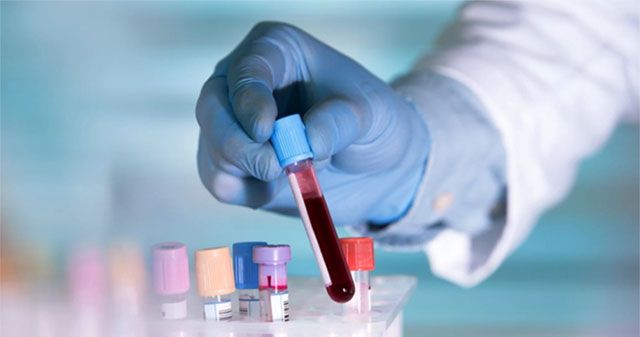 Revealing the secret of 'not eating anything before taking blood' and what happens if we 'accidentally eat'