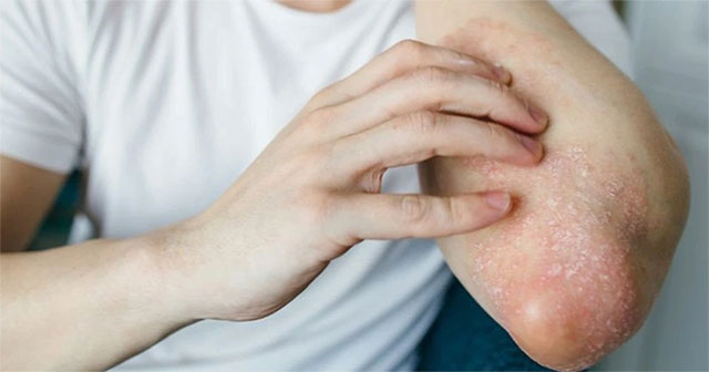 Science warns of a 'silent pandemic' approaching