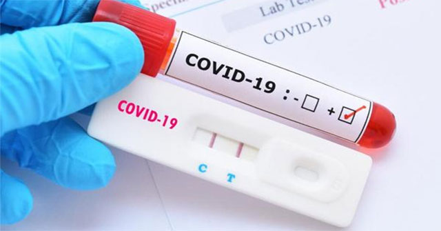 Scientists develop Covid-19 bait from healthy cells